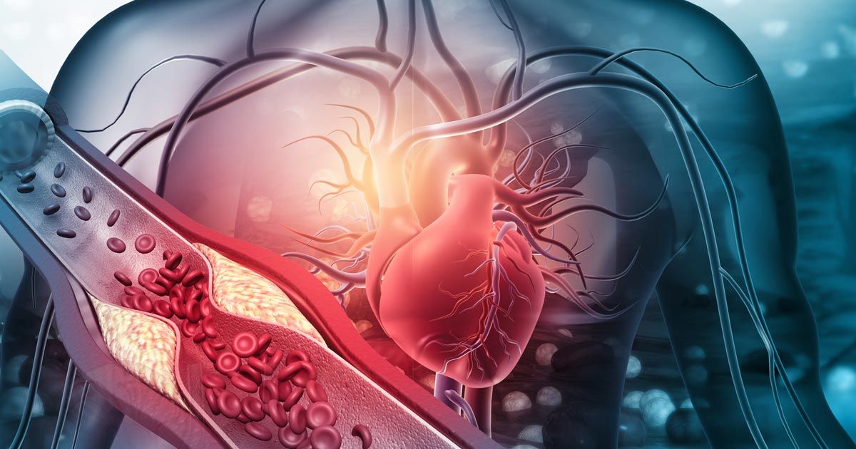 Wyższy poziom cholesterolu wiąże się z dłuższym życiem