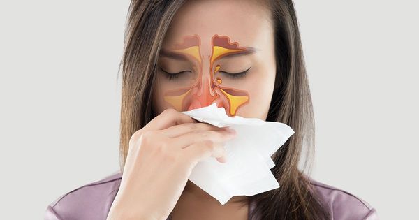 Czy zielono-żółta wydzielina z nosa oznacza, że masz infekcję zatok?