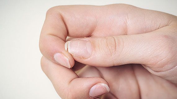 10 problemów zdrowotnych, które można rozpoznać po wyglądzie paznokci