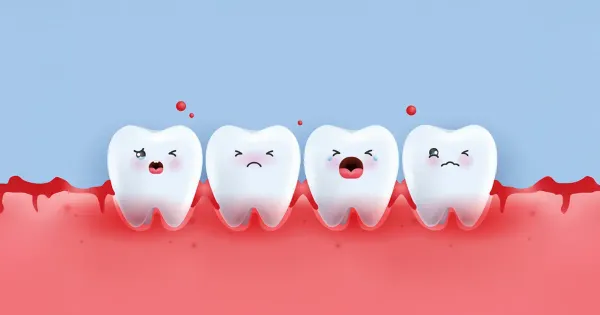 Objawy chorób dziąseł wiążą się ze zwiększonym ryzykiem wystąpienia wielu chorób przewlekłych